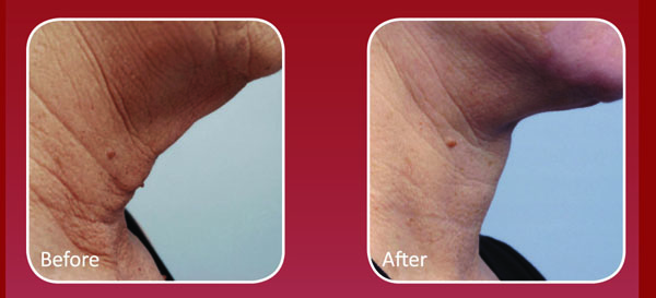 Richmond Hill Spa Namaste Forma Firm